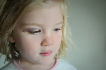 Texas Child Loses Eye After Firework Accident iStock 000011387633XSmall