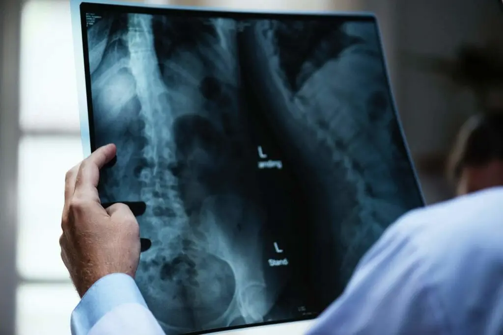 Common Causes of Spinal Cord Injuries pexels photo 721166
