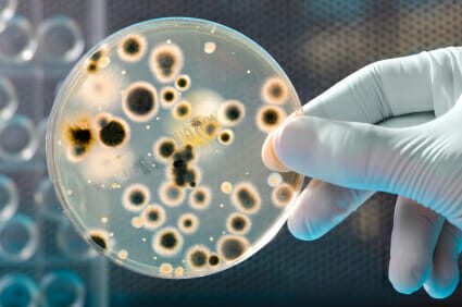Medical professional holding a petri dish containing specimen.
